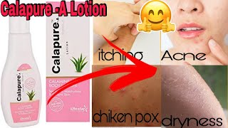 Calapure A Lotion Uses  Calamine Lotion  Review in English [upl. by Annahsohs]