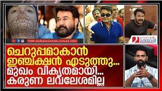 മുഖം വികൃതമായി മോഹൻലാലിന് ഇനി താടി വടിയ്ക്കാനാവില്ല I mohanlals brother [upl. by Anivahs]