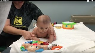 BABY GETS PHYSICAL THERAPY FOR TORTICOLLIS [upl. by Shuman]