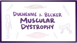 Duchenne amp Becker muscular dystrophy  causes symptoms treatment amp pathology [upl. by Greg]