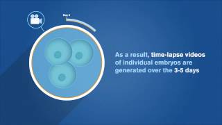 EmbryoScope Patient Information [upl. by Monika]