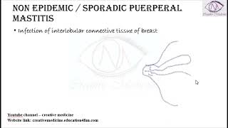 Lec 2 Puerperal Mastitis [upl. by Thompson]