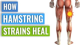 Hamstring Strain Healing  How Your Body Heals A Hamstring Strain [upl. by Charleen989]