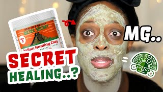 Honest Review 14 days WITH Aztec Secret Indian Healing Clay Mask [upl. by Sayles784]