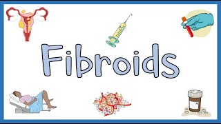 Uterine Fibroids  Types Causes Risk Factors Signs amp Symptoms Diagnosis amp Treatment [upl. by Groscr]