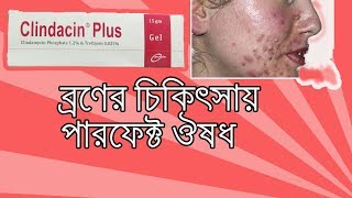 Clindacin Plus Gel  what is clindamycin gel used to treat Bangla [upl. by Arica50]