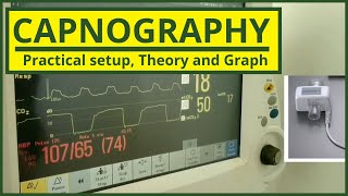 What is Capnography  Continuous Waveform Capnography  Sidestream Mainstream  Diagnotherapy [upl. by Cadal]