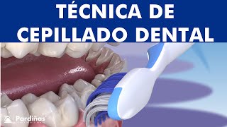 La mejor técnica para CEPILLARSE los dientes  Bass Modificada © [upl. by Aymik]