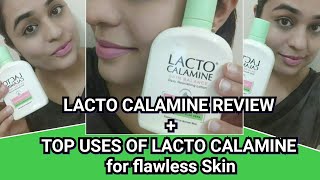 LACTO CALAMINE LOTION REVIEW AND USES [upl. by Davies888]