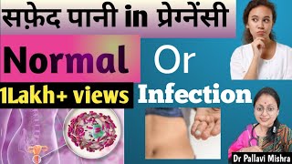 क्या pregnancy में white discharge नार्मल हैप्रेग्नेसी में व्हाइट डिस्चार्ज का क्या कारण है Hindi [upl. by Onidranreb739]