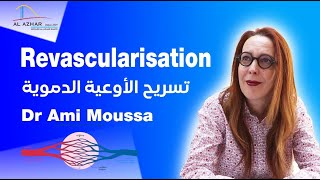 Chirurgie Vasculaire  Revascularisation avec le Dr Ami Moussa  تسريح الأوعية الدموية [upl. by Waylon319]