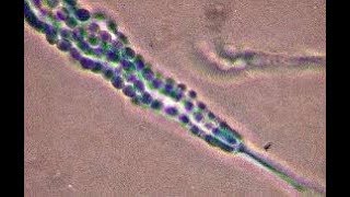 Penicillium cheresanum showing single celled conidia [upl. by Feingold]