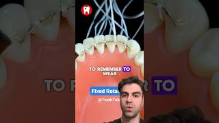 Why You Need a Fixed Retainer Dental Health 101 [upl. by Campy288]