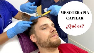 MESOTERAPIA CAPILAR ¿Qué es [upl. by Ecad936]