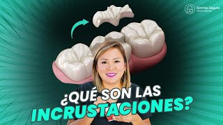 Incrustaciones Dentales Solución Estética y Duradera para Tu Sonrisa [upl. by Nevets]