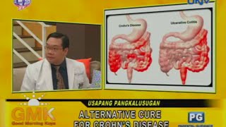 Alternative Cure for Crohns Disease [upl. by Bein601]