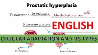 Cellular Adaptation with Histological slide in English [upl. by Perkin21]