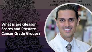 What are Prostate Cancer Gleason Scores and Grade Groups – Dr Ahdoot explains [upl. by Kiki91]