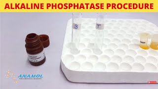 Alkaline Phosphatase Test  ALP Test [upl. by Nnanerak63]