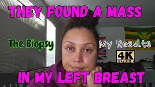 They Found A Mass In My Left Breast  My Biopsy  The Results  Biopsy Mammogram BreastHealth [upl. by Icyaj]