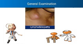 General Examination  Lymphadenopathy  Clinical significance of Lymphadenopathy  Virchow Nodes [upl. by Chladek]