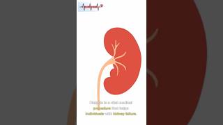 dialysis procedure video  dialysis medical foryou shorts [upl. by Novyart]