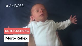 MoroReflex  Frühkindliche Reflexe  AMBOSS Video [upl. by Stephani]