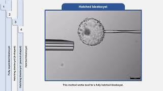 An innovative design for trophectoderm biopsy without laser pulses A stepbystep demonstration [upl. by Ytsihc]