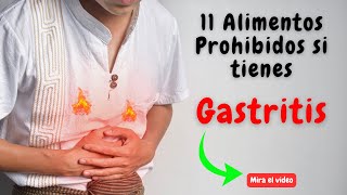 ❌¡ALERTA 11 ALIMENTOS Prohibidos para la GASTRITIS Acidez y REFLUJO que Debes Evitar🌶️ PROHIBIDO⛔ [upl. by Atined145]