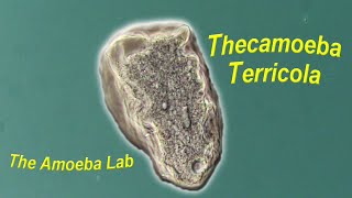 Amoeba  Thecamoeba Terricola by The AmoebaLab [upl. by Collette]