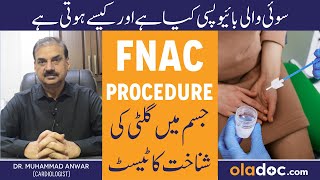 FNAC Kya Hota Hai  Needle Biopsy Kese Hoti Hai  How To Diagnose Abnormal Lumps  FNAC Procedure [upl. by Nyral]