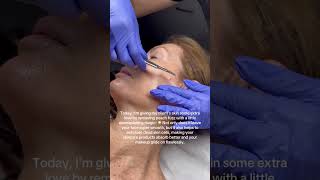 Dermaplaning  procedure benefits and risks [upl. by Woermer767]