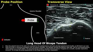 How To Scan The Biceps Tendon On Ultrasound  Shoulder USG Probe Positioning amp Image Orientation [upl. by Ashwin]