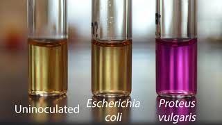 Demo Biochemical Tests  Urease Test [upl. by Drahcir]