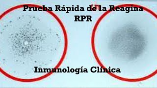 Prueba Rápida de la Reagina RPR [upl. by Atilol4]