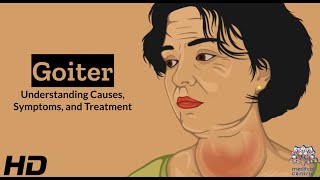 Thyroid Troubles Navigating Goiter  Causes Symptoms and Treatment Explained [upl. by Holli624]