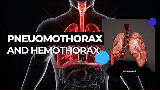 Pneumothorax and Hemothorax  Types amp Management [upl. by Aruol]