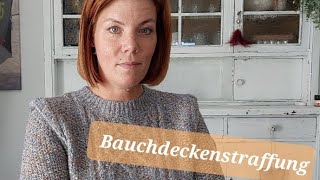 Bauchdeckenstraffung nach Magenbypass OP [upl. by Eseilana922]