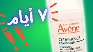 سيطري علي الحبوب Avene Cleanance Comedomed [upl. by Mitinger]