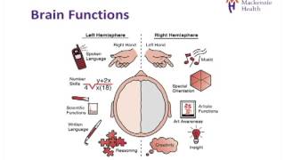 Stroke Education  Causes and Effects [upl. by Berkman]