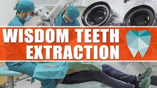 Wisdom teeth extraction with surgery microscope  DENTAL NETWORK IN LEEDS [upl. by Ayardna]