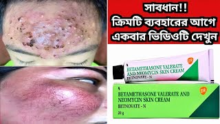 Betnovate n skin cream  বেটনোভেট এন ক্রিম এর কাজ কি ত্বক ফর্সাকারী ক্রিম  Betnovate N Cream [upl. by Filomena]