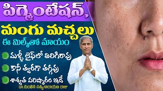 Home Remedies for Pigmentation  How to Remove Mangu Machalu  Dr Manthena Satyanarayana Raju Videos [upl. by Tiram239]