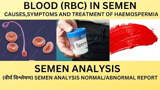 BLOOD IN THE SEMENRBC IN THE SEMEN ANALYSIS CAUSES AND TREATMENT OF BLOOD IN THE EJACULATE [upl. by Joleen179]