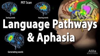 Language Pathways and Aphasia Animation [upl. by Ivett565]