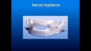 Obstructive Sleep Apnea Part 10 Oral Appliances Appliance Selection [upl. by Lalla]