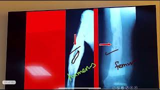 Orthopedics’ revision [upl. by Glaser]