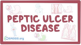 Peptic ulcer disease  causes symptoms diagnosis treatment pathology [upl. by Comstock118]