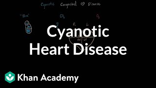 What is cyanotic heart disease  Circulatory System and Disease  NCLEXRN  Khan Academy [upl. by Valera]