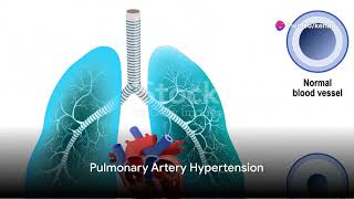 Understanding Pulmonary Circulation and Pulmonary Artery Hypertension PAH [upl. by Cired]